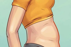 Béo bụng tăng nguy cơ ung thư