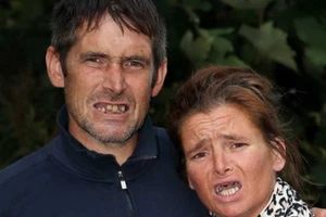 Đôi uyên ương tự nhổ hàm răng