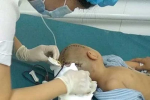 Bé 3 tuổi bị chấn thương sọ não ở trường mầm non