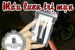 Thực hư chuyện làm đẹp bằng máu lươn