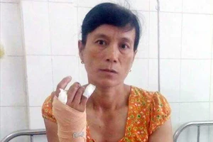 Đánh hàng xóm, thư ký tòa bị tù treo