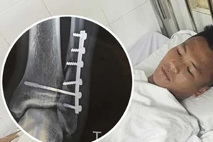 Báo động những pha vào bóng hủy diệt 