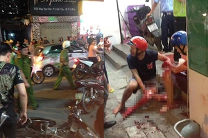 Công an khuyên 3 điều phải nhớ khi bị cướp giật