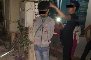 Nhân danh gì mà đánh đập, cột cổ người trộm chó?