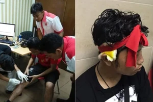 Cổ động viên Myanmar tố bị đánh sau trận Malaysia - Myanmar