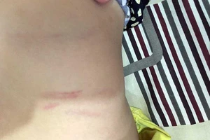 Con bị đánh, cha đề nghị trường bồi thường… 100 triệu đồng