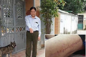 Làm rõ vụ bị cảnh sát 113 bắn vào đùi