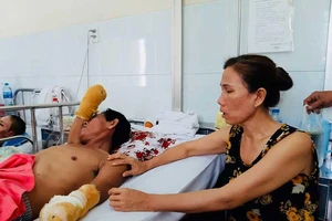 Anh chỉ còn đôi tay cụt để quệt nước mắt