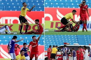 Đề cử Fair Play trọng tài cứu cầu thủ cắn lưỡi