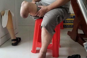 Cục Người có công trả lời về việc giám định lại vết thương