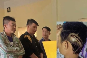 Chém nứt sọ người khác, xử tội gì?