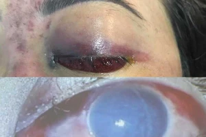 Tìm cách trị cơ sở thẩm mỹ làm dịch vụ chui