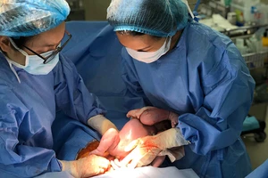 Truyền máu song thai không cần phải ra nước ngoài