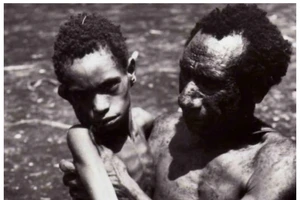 Bộ tộc ăn não người và 'chìa khóa' chống bệnh mất trí nhớ