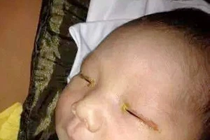 Chụp 'tự sướng', vô tình làm trẻ sơ sinh mù lòa