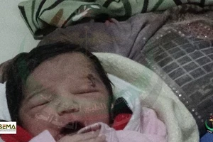 Kỳ diệu bé gái chào đời với mảnh đạn ghim vào đầu