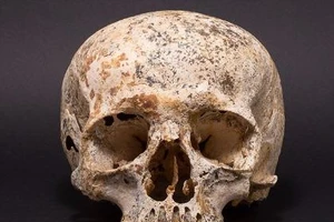 Giải mã tục bó đầu kỳ lạ từ gương mặt người chết 3.700 trước