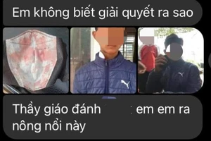 Bị thầy giáo 'quơ trúng', học sinh chảy máu mũi ngay giữa sân trường
