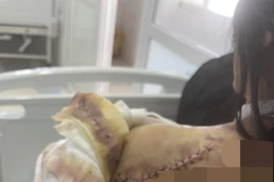 Công an tăng cường bảo vệ 1 phụ nữ 2 lần bị truy sát