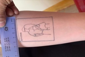 Xăm hình lên tay để trốn nghĩa vụ quân sự, một thanh niên bị phạt
