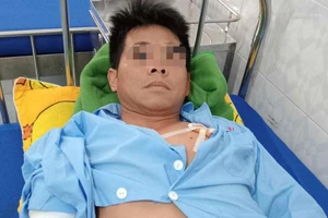 Một chú chó Becgie ở Đắk Lắk lao vào cắn chủ bị thương nặng