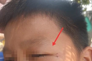  Công an TP Buôn Ma Thuột thụ lý vụ 5 cháu nhỏ bị đánh