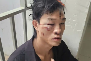 Đi ăn hủ tiếu khuya, thanh niên tỉnh dậy ở trạm xá với nhiều vết thương