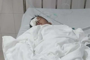 Xác minh vụ việc học sinh lớp 1 nghi bị đánh có nguy cơ mù mắt