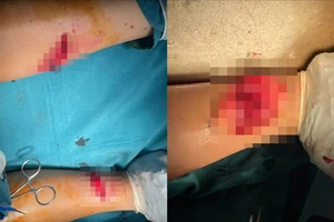 Nữ du khách bức xúc vì cho rằng tin báo khỉ tấn công bị bỏ lơ