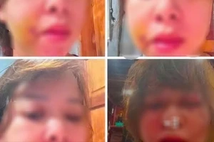 Người vợ ở Đắk Lắk tố cáo bị chồng đánh đập dã man sau sinh 