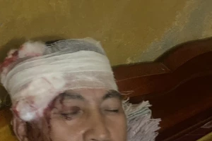 Tàu hỏa phải dừng khẩn cấp vì lái phụ bị ném đá trúng đầu