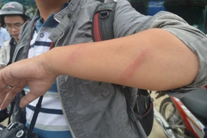 Người đàn ông đuổi đánh các phóng viên tại hiện trường vụ thảm sát ở Bình Phước 