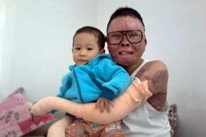 Chiến sĩ duy nhất sống sót trong vụ rơi máy bay tại Hòa Lạc giờ ra sao?