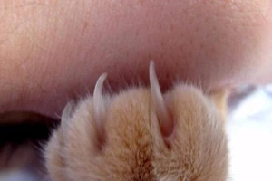 Thanh niên mắc chứng bất lực sau khi bị mèo cào