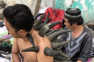 Giác hơi bằng sừng: Lợi, hại thế nào?