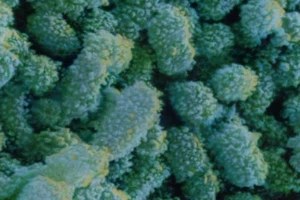 Căn bệnh vắng bóng 5 năm quay trở lại