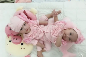 Bác sĩ trực tiếp tách cặp Song Nhi: 'Cảm xúc như thuở ban đầu'