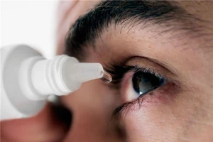 Nhìn vào mắt người bị đau mắt đỏ có lây bệnh không?