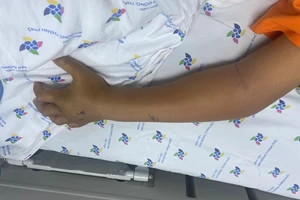 Ra sau nhà bếp đánh răng, bé trai 8 tuổi bị rắn lục cắn nguy kịch