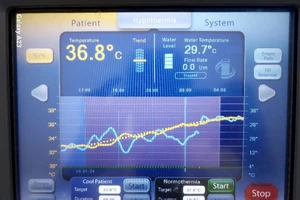 Đang tập văn nghệ, nữ sinh 18 tuổi bất ngờ chóng mặt, suýt đột tử 