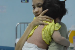 Các giải pháp bảo vệ trẻ trước dịch bệnh sởi ở TP.HCM