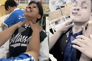 Trào lưu ‘bắt pen cổ gây xỉu’: Coi chừng đột quỵ do thiếu máu