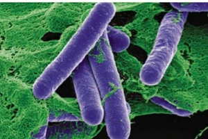 Ngộ độc botulinum sau khi ăn pate đóng hộp