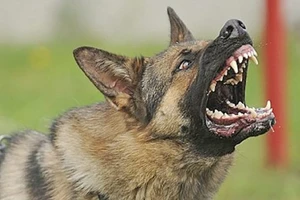 Bé trai 5 tuổi bị chó cắn biến dạng khuôn mặt