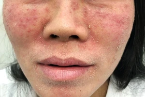  Làm đẹp cấp tốc đón Tết, nhiều người 'tiền mất tật mang'