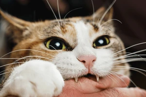 Từ vết mèo cắn nhỏ, người phụ nữ rơi vào sốc nhiễm khuẩn nguy kịch