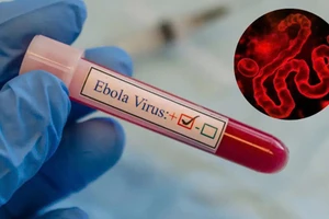 TP.HCM siết giám sát cửa khẩu, ngăn nguy cơ dịch Ebola xâm nhập cộng đồng