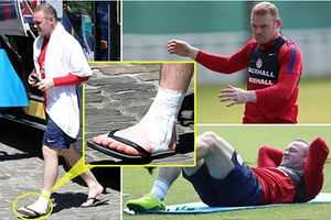 Fan Anh lo sốt vó khi thấy Rooney băng chân