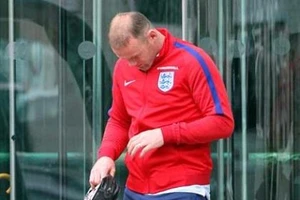 Tóc Wayne Rooney biến mất bí ẩn sau trận thua thảm hại trước Iceland