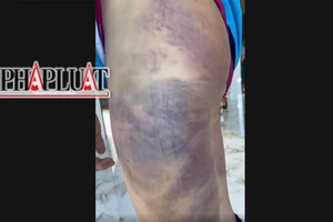 UBND huyện Lâm Hà báo cáo vụ học sinh lớp 6 bị đánh